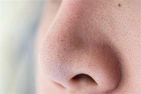 Хар батга, цагаан батга – MIRUSKINCARE