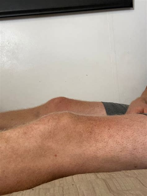 Knee Ligament Strengthening Exercises For Stronger Knees