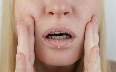 Lips Exfoliation: Best ways to get rid of dead skin cells on lips