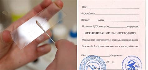 Анализ-соскоб на энтеробиоз - Паразиты в организме человека