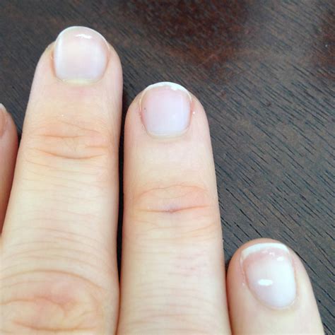 What Makes White Spots On Your Fingernails - Design Talk