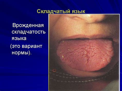 Изменения полости рта при заболеваниях внутренних органов - презентация ...