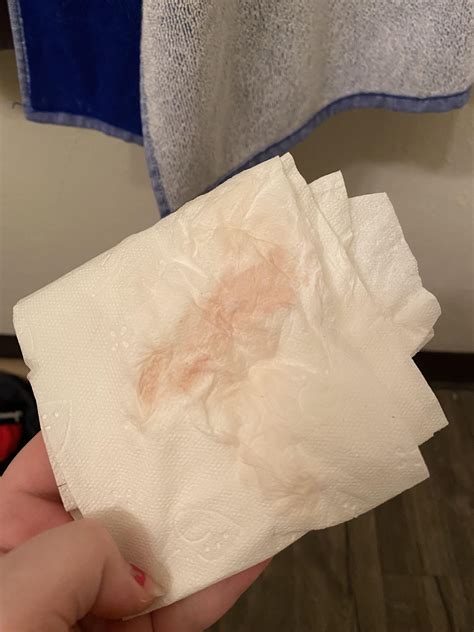 NSFW- Is this type of discharge normal? Intense cramping : r/endometriosis