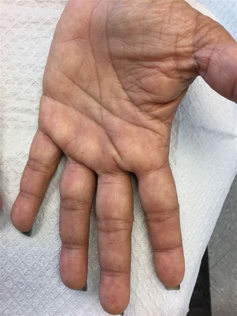 Make the Diagnosis - October 2017 | MDedge Dermatology