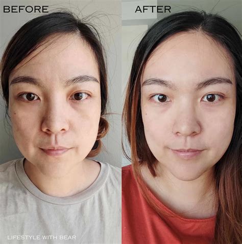 md formula brightening serum