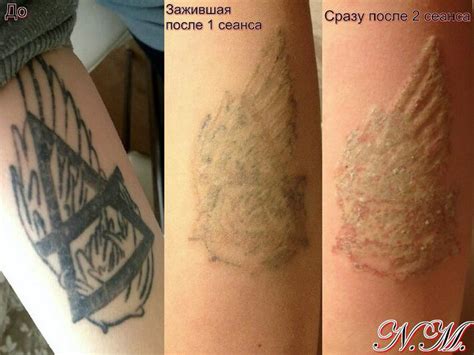 Этапы татуировки: от выбора мастера до заживления - tatpix.ru