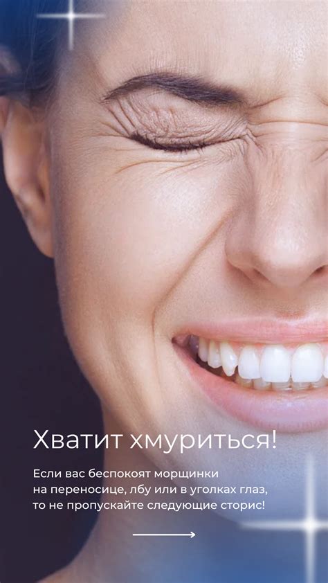Ботокс сторис ботулинотерапия диспорт stories для косметолога ...