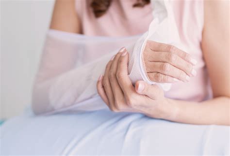 10 Essential Tips for a Quick Broken Arm Recovery – Springrose