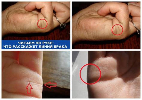 Где Линия Брака На Руке Фото — Фото Картинки