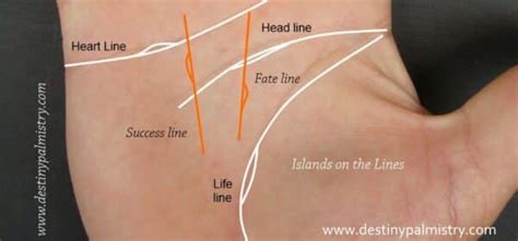 Island on Life Line Meaning in Palmistry - Destiny Palmistry