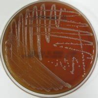 :: IC :: Infection & Chemotherapy