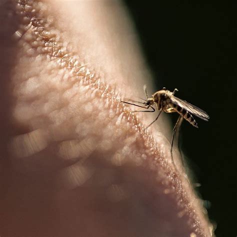 Why You Shouldn't Scratch a Bug Bite | The Healthy @Reader's Digest