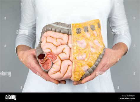 Human Intestines Picture