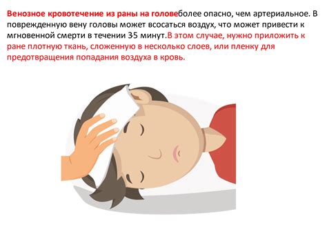 22. Первая помощь при кровотечениях
