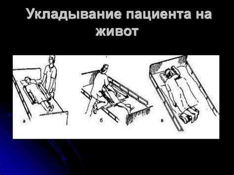 Различные положения пациента в постели: положение Симса, на спине, на ...