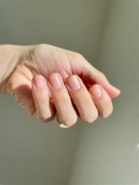 Dry And Cracked Fingernails