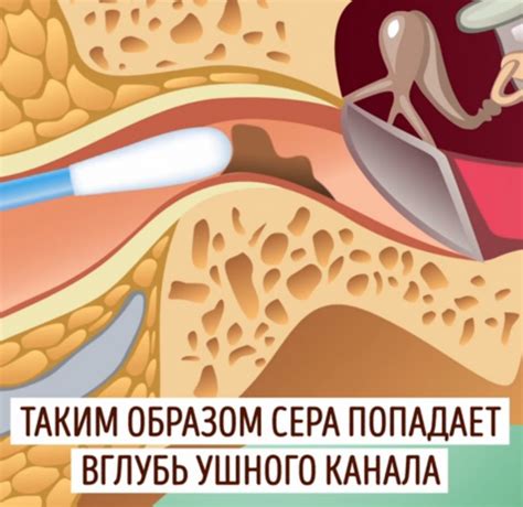 Почему нельзя чистить уши ватными палочками - Минута Знаний