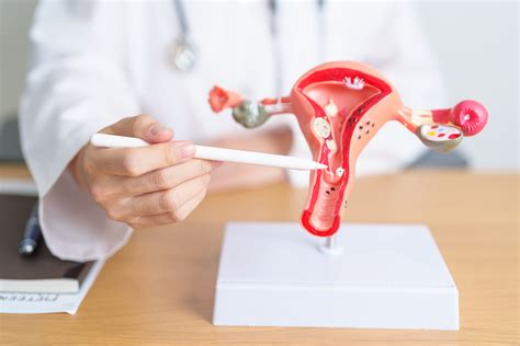Эндометриоз матки 👩‍🔬 у женщин – что такое, какие симптомы, как лечить ...