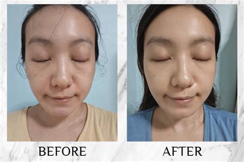 Topicrem DA Emollient Balm Reviews: Honest Readers' Opinions
