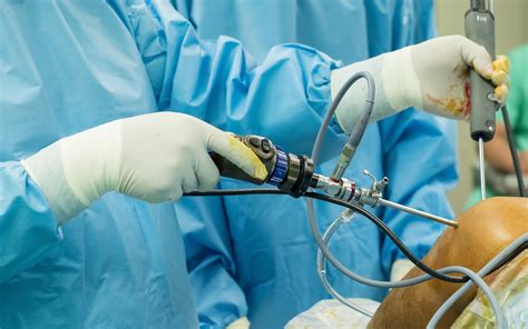 Arthritis Blog - Knee Arthroscopy, Osteoarthritis and the Relationship ...