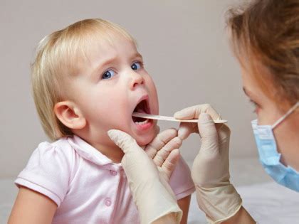 Aftozni stomatitis | Doktorica Mica