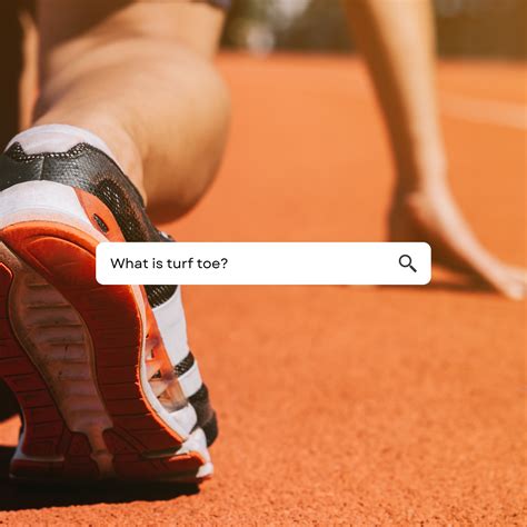 🏃🏻‍♂️ What is turf toe? A... - AcCELLerated Biologics, LLC