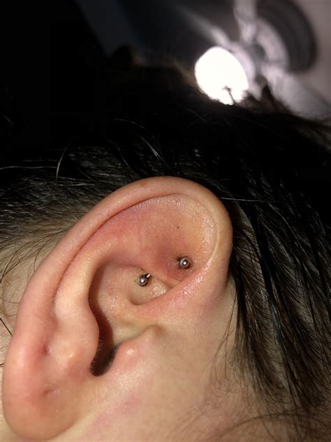 how to fix piercing bump