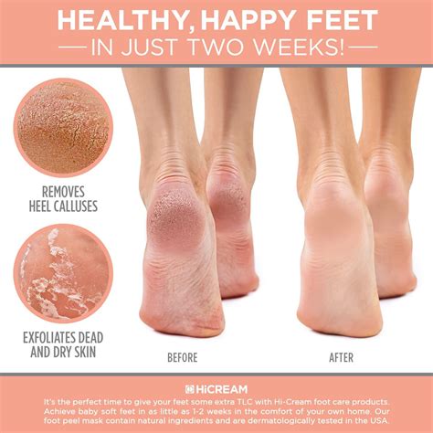 Foot Peel Mask for Cracked Heels & Calluses - Exfoliating Treatment to