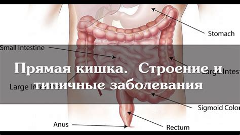 Прямая кишка. Строение и типичные заболевания - YouTube