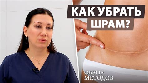 Как убрать рубцы после операции (обзор методов от пластического хирурга ...