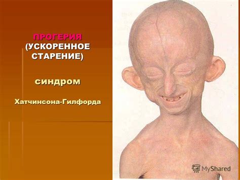 Презентация на тему: "Реактивность организма. Роль реактивности в ...