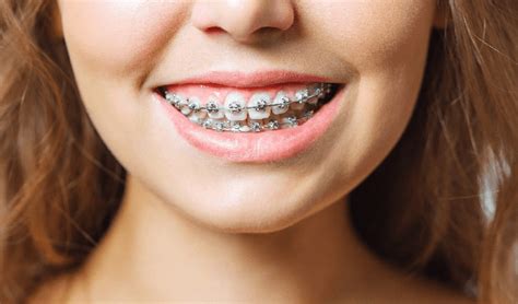 problems  orthodontists  fix