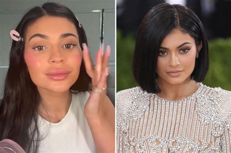 Kylie Jenner's fans beg star to stop with lip fillers as throwback ...