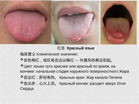 Традиционная диагностика по языку - online presentation