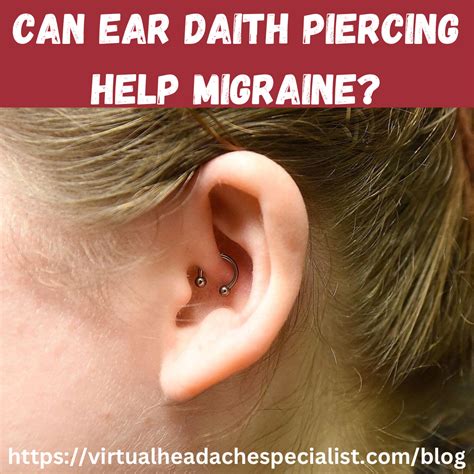 Ear piercing for migraines – Artofit
