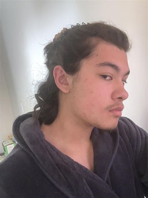 Is this Seb Derm? Doctor’s prescriptions haven’t worked. : r/SebDerm