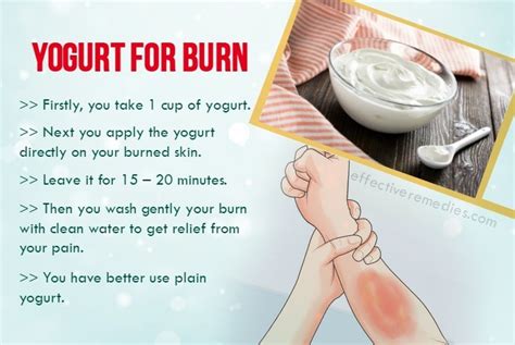 20 Natural Home Remedies for Burns on Skin Including Hand & Face