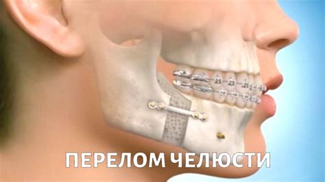 болит подбородок справа при нажатии что