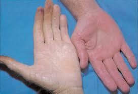 act  vocab flashcards quizlet