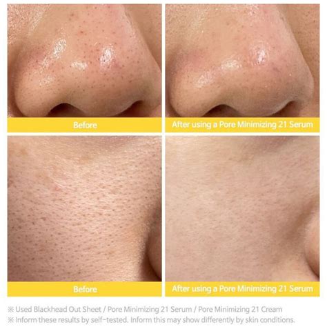 Pore Minimizing 21 Serum — Yeppo®