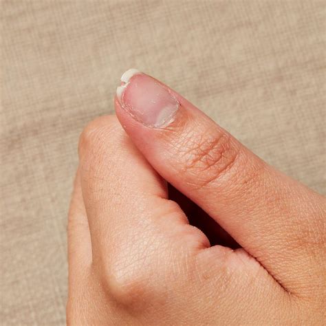 How To Fix Cracked Finger Nail at Tawny Dunn blog