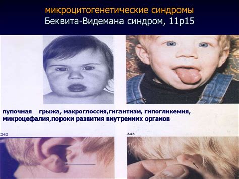 Хромосомные заболевания - презентация онлайн