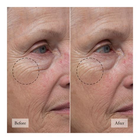 Buy Philosophy Ultimate Miracle Worker Fix Eye Fill & Firm Treatment ...