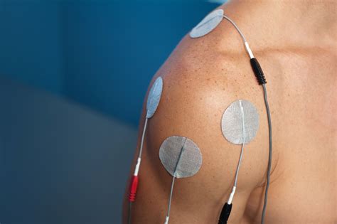 electrical stimulation therapy enhances healing pain arthritis