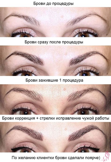 Заживление перманентного макияжа бровей после коррекции