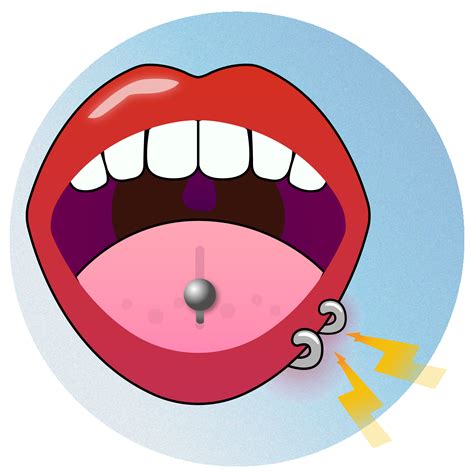 Illustration of an open mouth with a piercing in the tongue and two