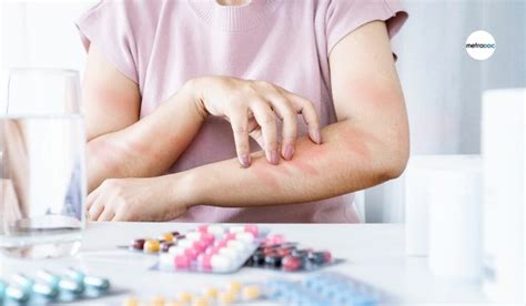 Urgent Care Role in Managing Allergic Reactions