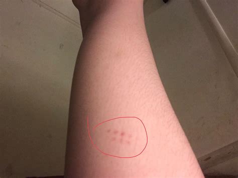 Is this something or am I over reacting : r/medical