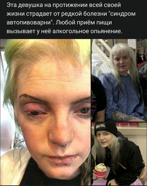 Пин от пользователя Kiwi Kevin Hader на доске Особенности тела/болезни ...