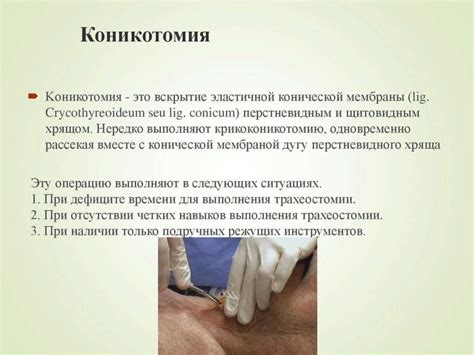 Трахеотомия. Трахеостомия. Коникотомия - презентация онлайн